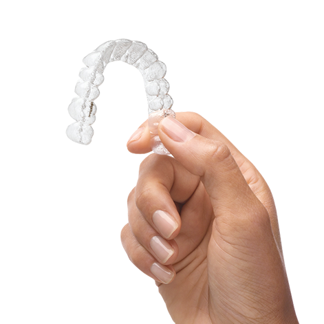Invisible braces