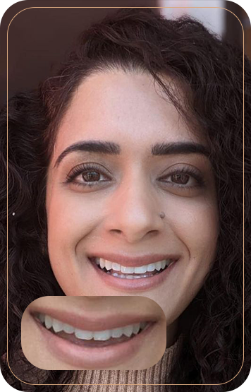 Unlock Confidence Through Your Smile