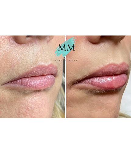 Facial Aesthetics Case