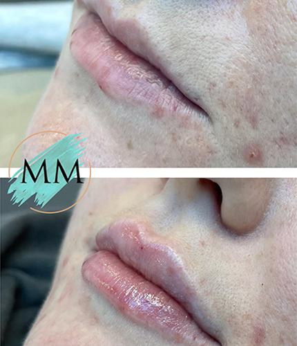 Facial Aesthetics Case